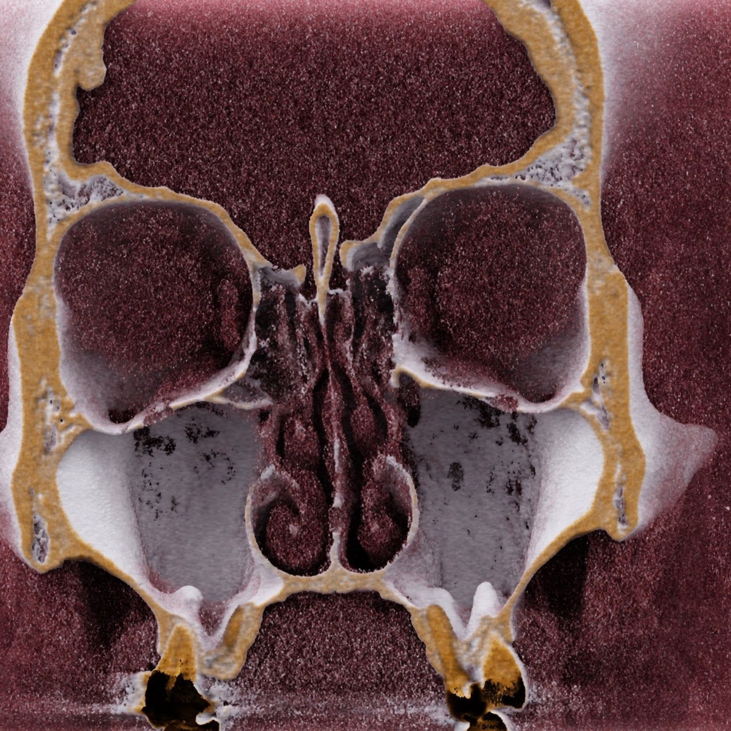 scanner des sinus clinique de l'oreille