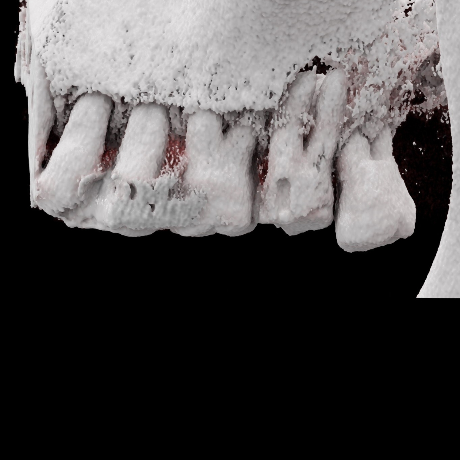 dentascanner