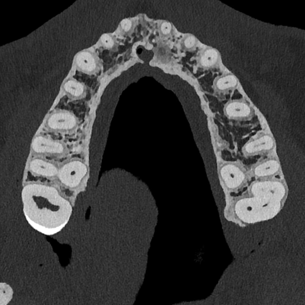 dentascanner clinique de l'oreille