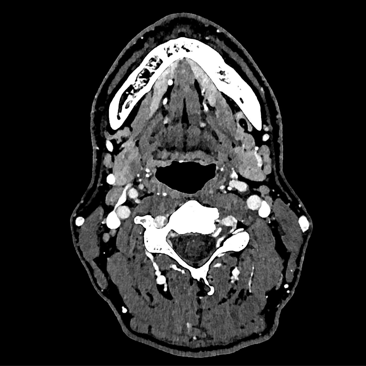 scanner cervicofacial