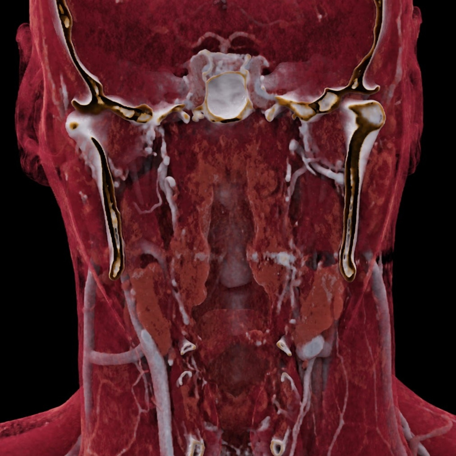 scanner cervicofacial