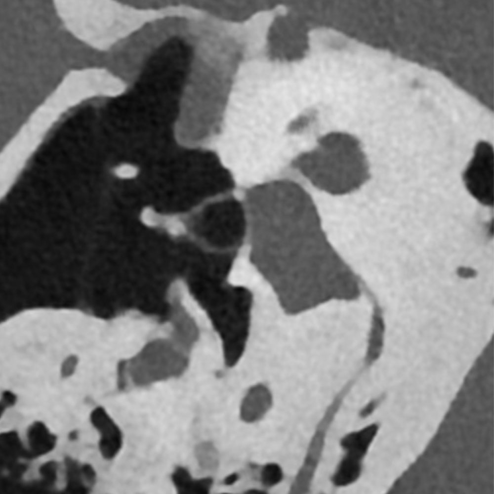 Scanner Rocher (1)