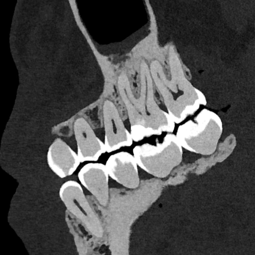 dentascanner