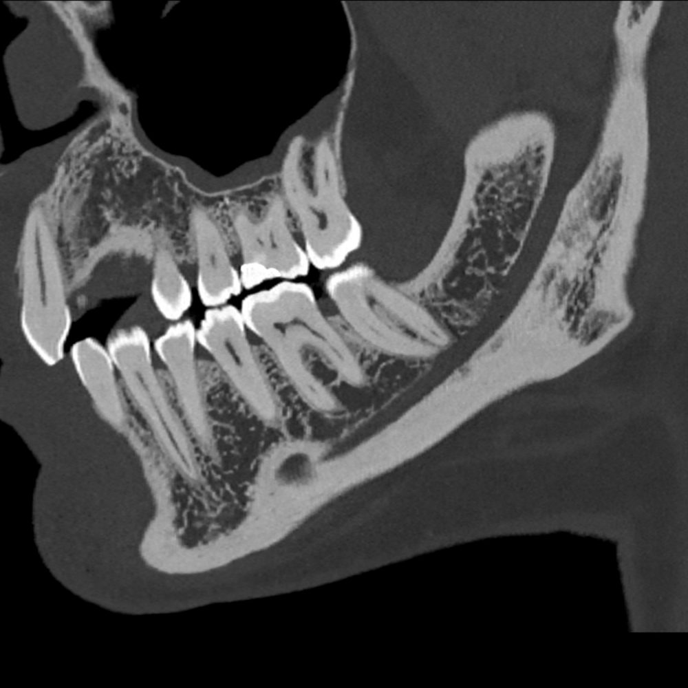 Dentascanner Clinique de l'oreille